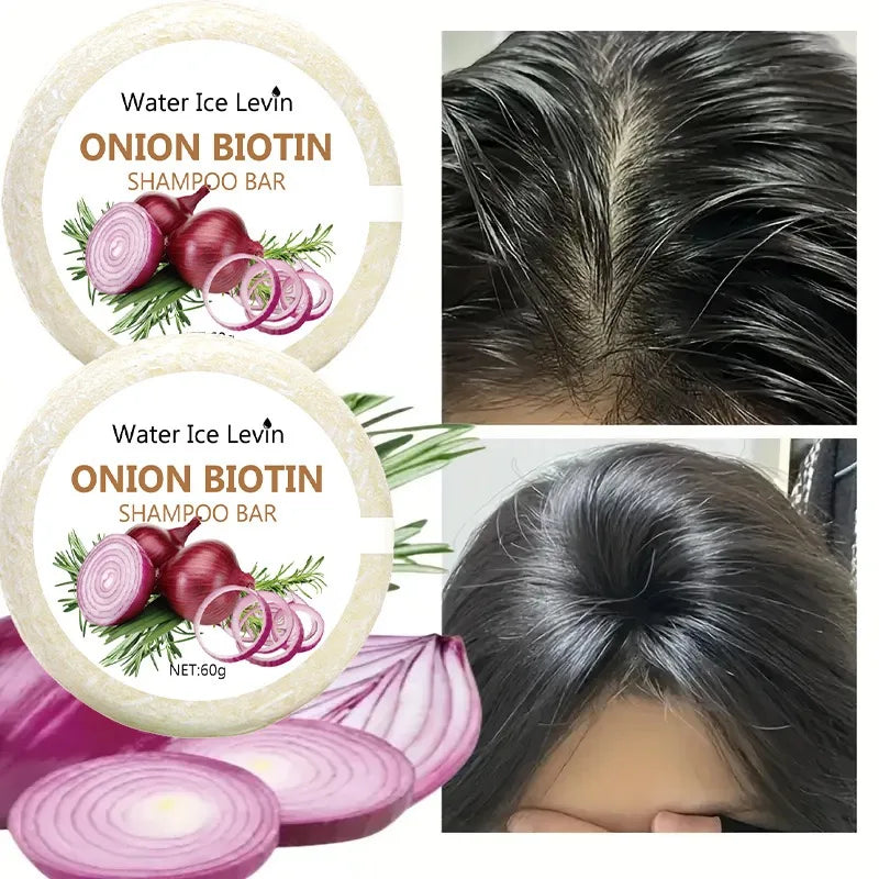 Onion & Biotin Shampoo Bar – Strengthening & Moisturizing for All Hair Types (60g)