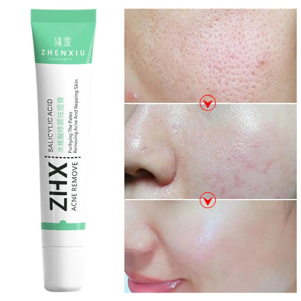 Salicylic Acid Pore Minimising Cream