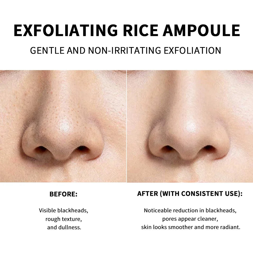 Rice Peeling Essence Serum — White & Black Rice