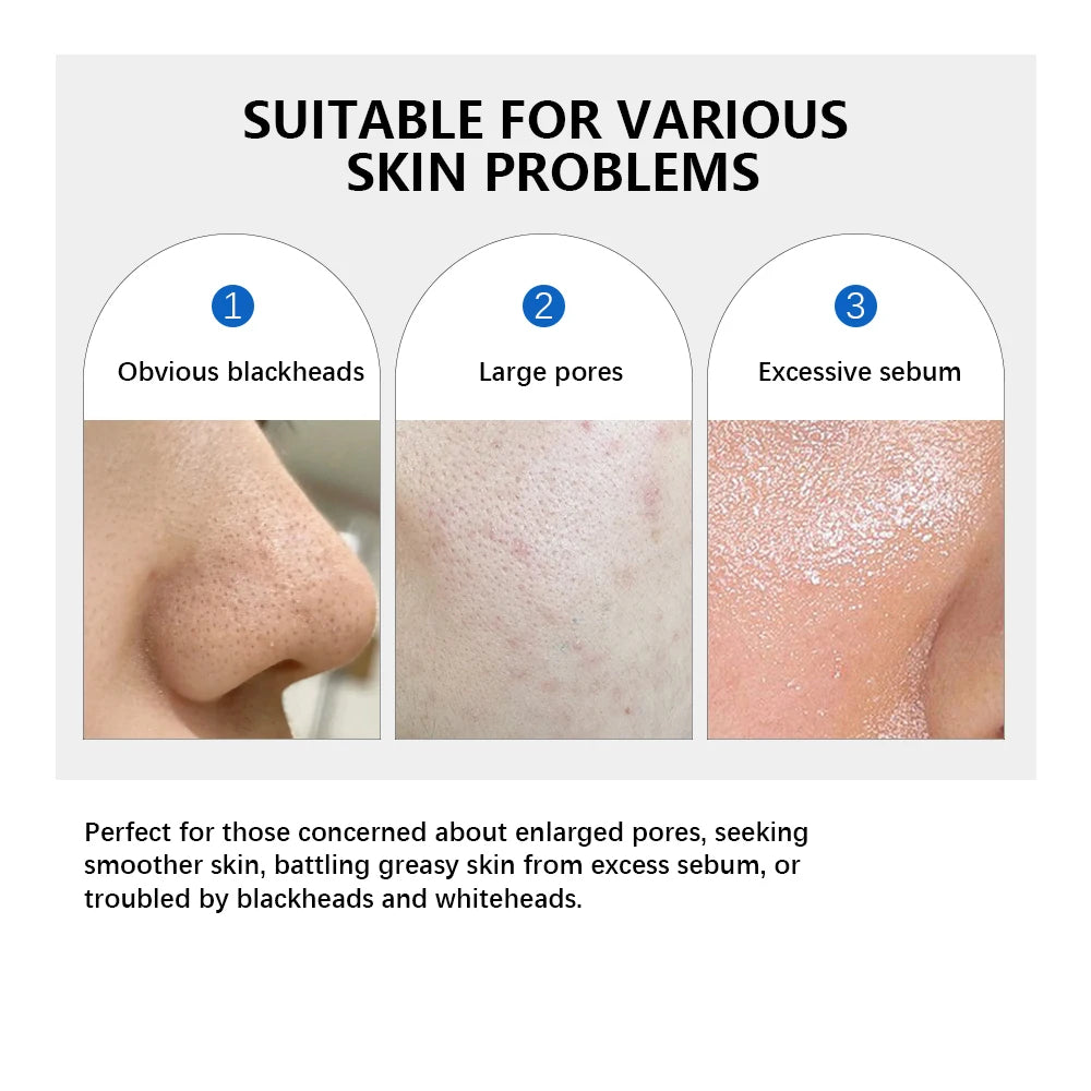 Korean Zero Pore Exfoliating Toner Pads 70 Pcs