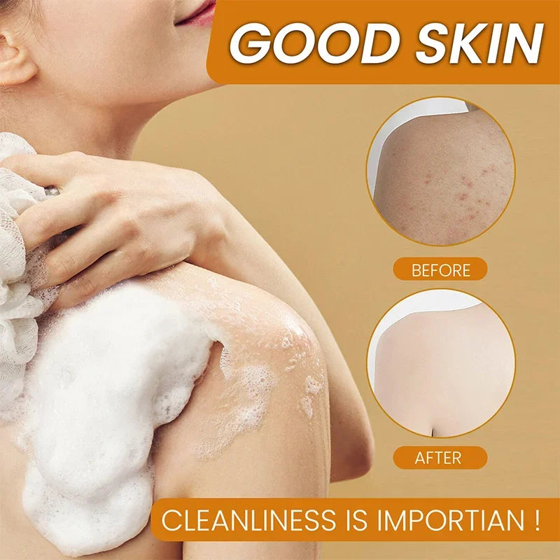 Turmeric & Kojic Acid Facial Soap – Deep Cleansing & Moisturizing Bar (100g)