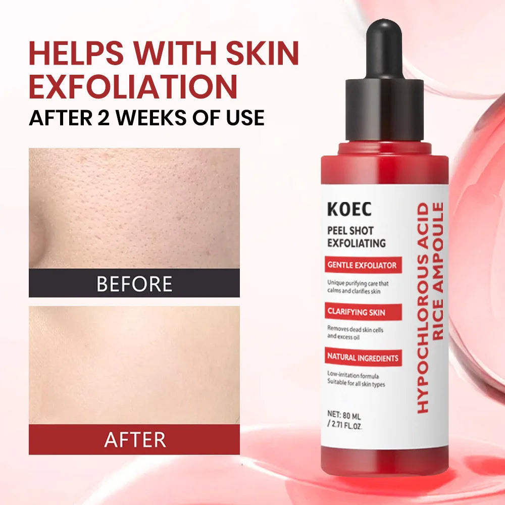 Rice Peeling Lotion Oil with Hypochlorous Acid — Exfoliate & Brighten